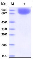 Human Vasorin Protein, His Tag