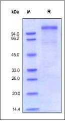 Human VLDL R Protein, His Tag