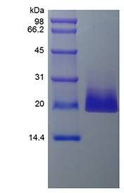 Human 4-1BB Ligand protein