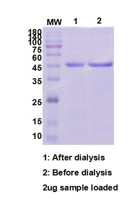 Human beta Actin protein