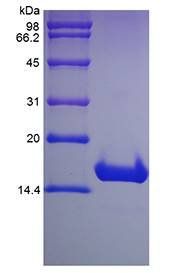 Human Cyclin-Dependent Kinase Inhibitor 2A protein