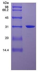 Human High-Mobility Group Box 1 protein