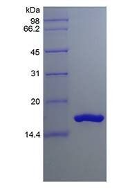 Human IL-36 beta (157a.a.) protein
