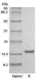 Human IL2 protein