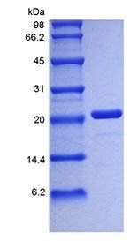 Human IL6 protein