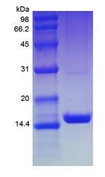 Human MEC protein