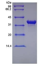Human MHC class chain-related gene A protein