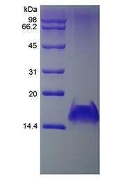 Human MIG protein