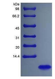 Human NRG1-beta 1 protein