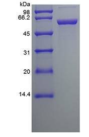 Human PDI protein