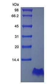 Human Proinsulin C-Peptide Analogue protein