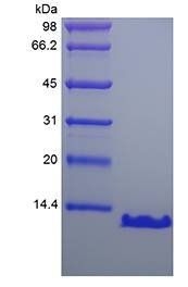 Human PTH7-84 protein