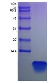 Human PTH (1-34) protein