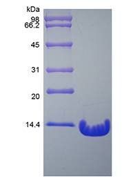 Human PTH (1-84) protein