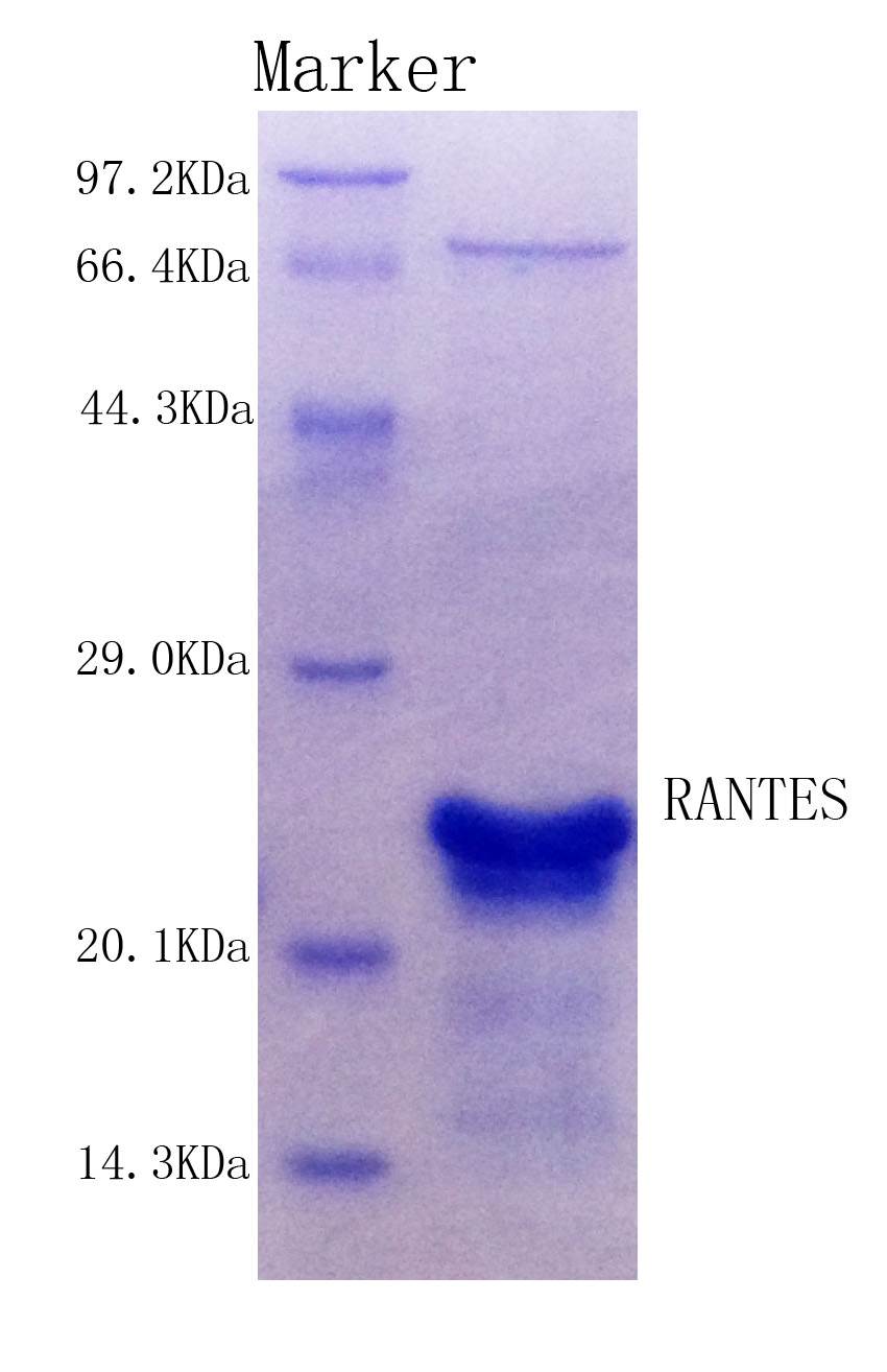 Human RANTES protein