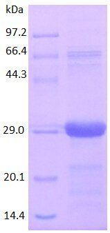 Human RANTES protein