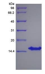 Human SDF-1 gamma protein