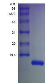 Human SDF 1 beta protein