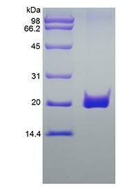 Human sFasR protein