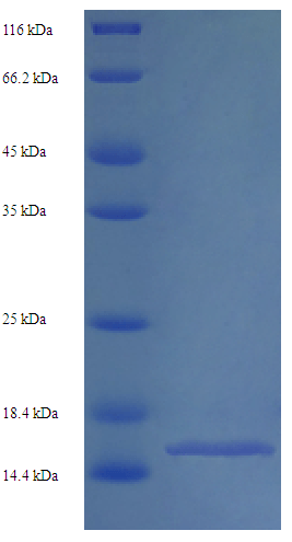 Recombinant Human Sodium-dependent phosphate transport protein 2B (SLC34A2), partial