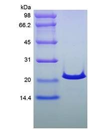 Human Sonic HedgeHog protein