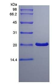 Human Trefoil Factor-1 protein