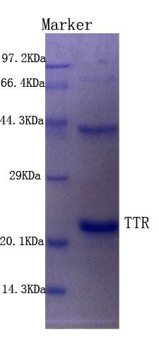 Human Transthyretin protein