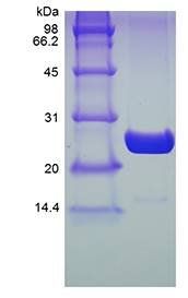 Human UBC1 protein