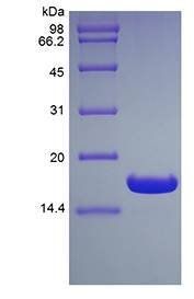 Human UBC2 protein