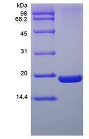 Human Ubiquitin-Conjugating Enzyme E2I protein