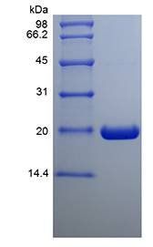 Human Ubiquitin Conjugating Enzyme E2C protein