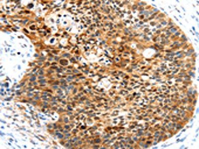 HUNK Antibody