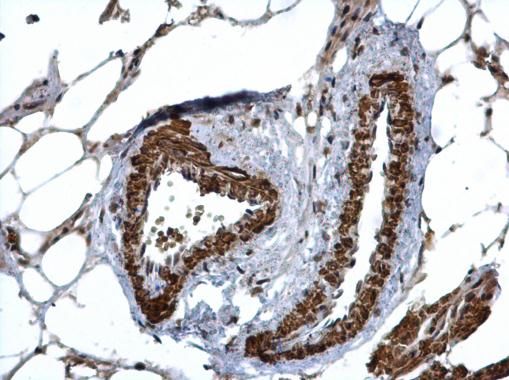 HUS1 antibody