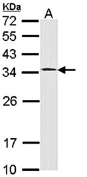 HUS1 antibody