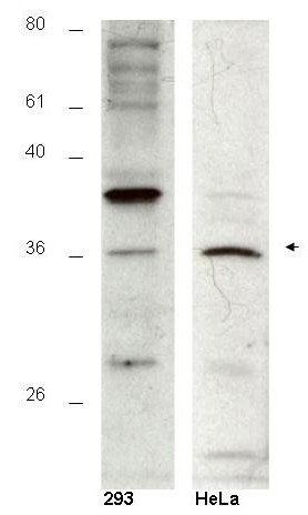 Hus1B antibody