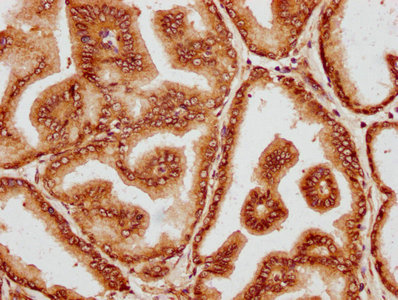 HUS1B Antibody