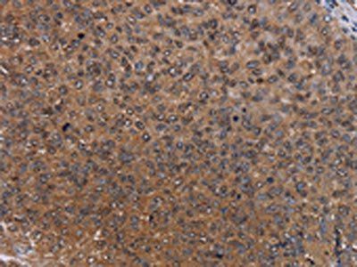 HYAL2 Antibody