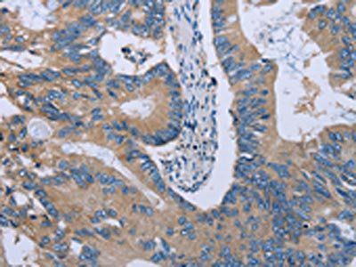 HYAL3 Antibody