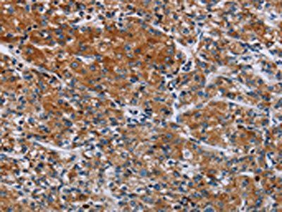 HYAL3 Antibody