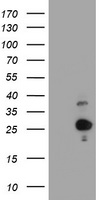 Hydroxysteroid (17 beta) Dehydrogenase 4 (HSD17B4) antibody