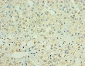 HYLS1 Antibody