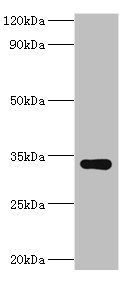 HYLS1 Antibody