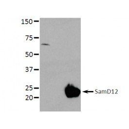 SamD12 Rabbit Polyclonal Antibody