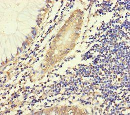 HYPM Antibody