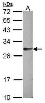 hypothetical protein LOC159090 antibody
