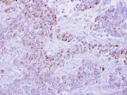 C-C motif chemokine ligand 1 Antibody