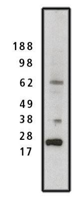 Rabbit anti Human SET, Phosphatase 2A Inhibitor I2PP2A