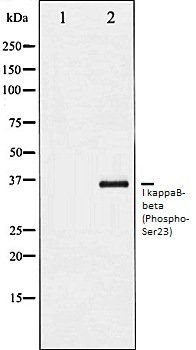 I kappaB-beta (Phospho-Ser23) antibody