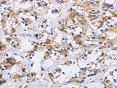 IAPP Antibody