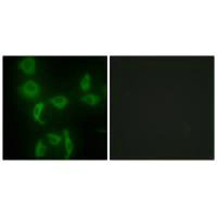 IARS2 antibody